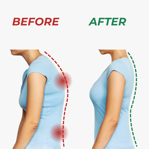 PM Protocol™ PostureGuard | Smart Posture Monitor